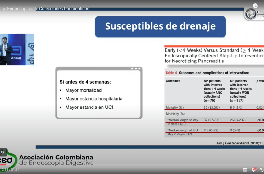  Drenaje endoscópico de colecciones pancreáticas. Nicolás Zuluaga MD. U. CES