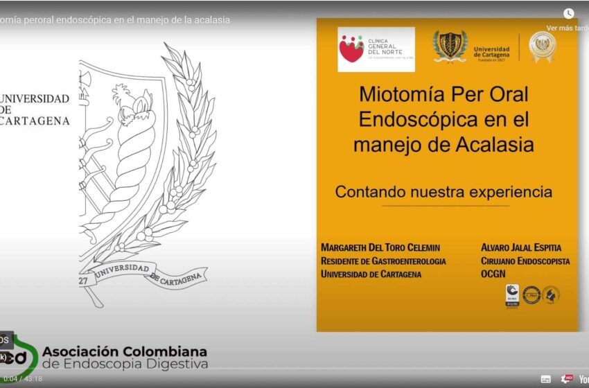  Miotomía peroral endoscópica en el manejo de la acalasia. Margareth del Toro. U de Cartagena.