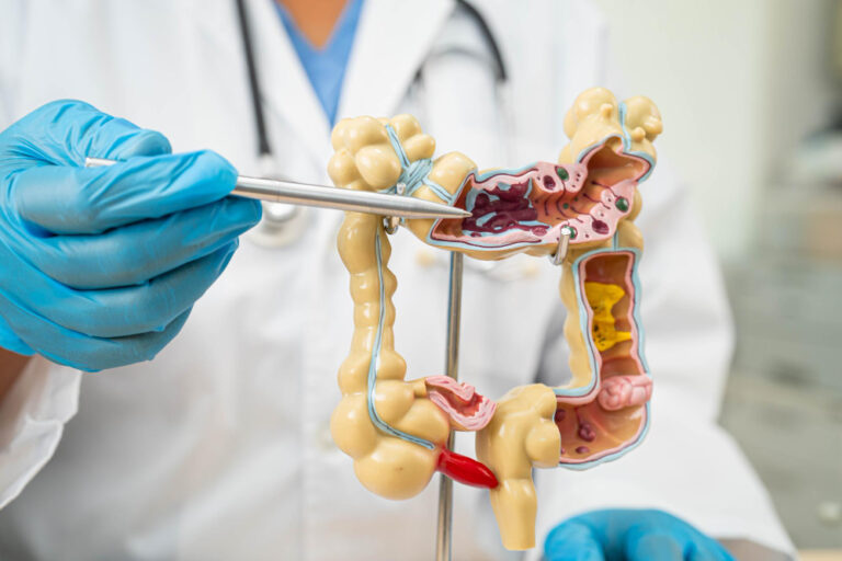 Cáncer de colon: la prevención y detección temprana salvan vidas